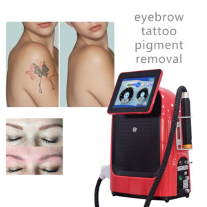 Q Switch Nd Yag Pigmentation Removal Pico Laser Tattoo Removal Picosecond Laser Machine