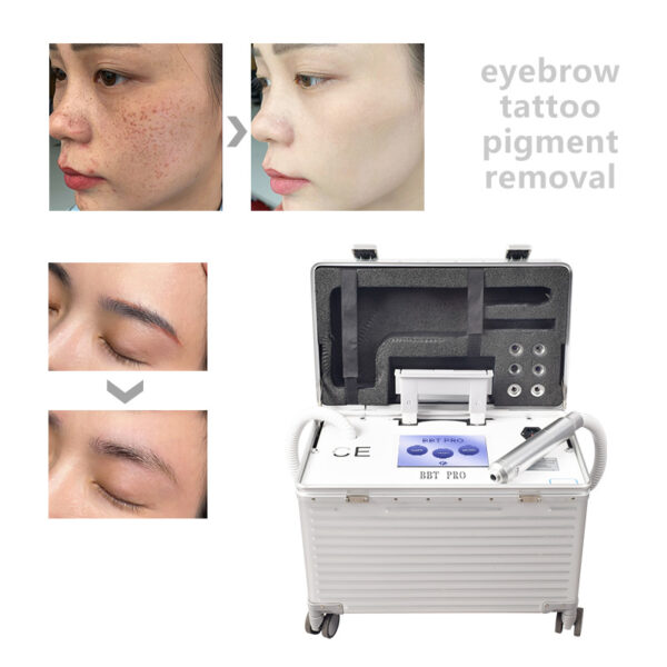 Portable Switched Nd Yag Laser Picosecond Carbon Peeling Beauty Trolley Case Pigment Removal Device